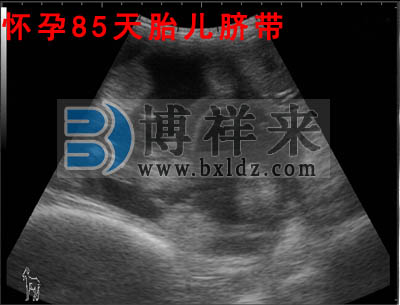 母羊懷孕85天超聲影像圖