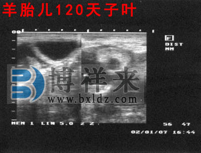 母羊懷孕120天超聲影像圖