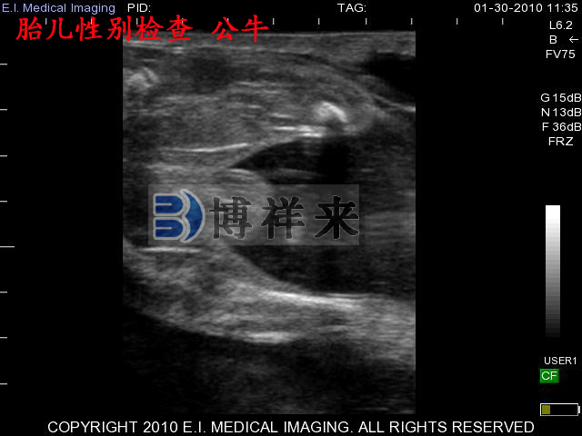 牛用B超，奶牛B超學(xué)習，奶牛懷孕60天B超影像學(xué)習